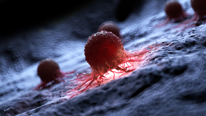 Zahubíme nádorové buňky hladověním? Efekt půstu na rakovinu zatím není zcela jasný.