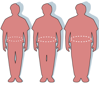 Zleva doprava: „zdravý“ muž má obvod pasu 84 cm, muž s nadváhou 114 cm a obézní jedinec 152 cm.