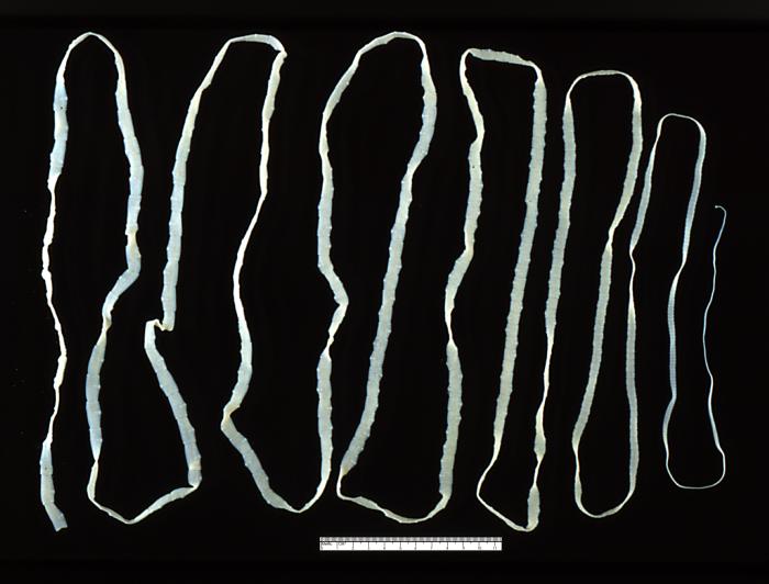 Pro tasemnici bezbrannou (Taenia saginata) je člověk definitivním hostitelem. Nakazit se lze nedostatečně tepelně upraveným hovězím masem s boubelemi, což je vývojové stádium tasemnic v tkáních mezihostitele. Nejčastěji dosahuje délky 3–5 metrů, ale může měřit až 12 metrů.
