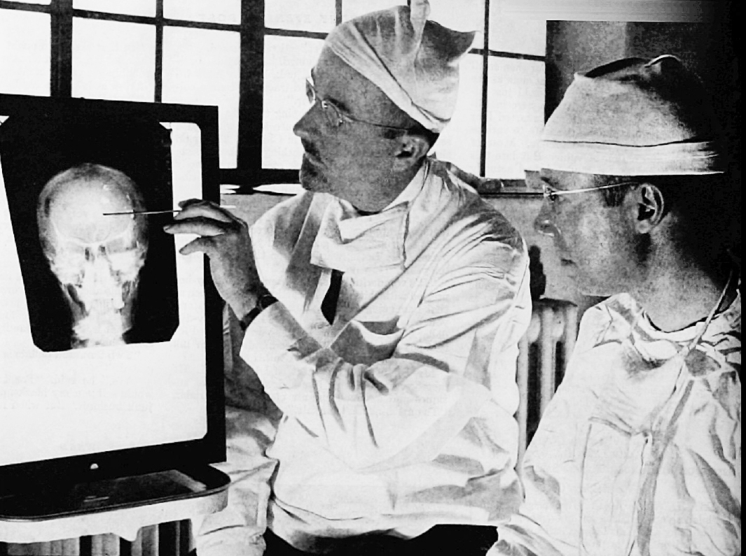 Dr. Walter Freeman (vlevo) a Dr. James W. Watts studují rentgenový snímek před provedením lobotomické operace.