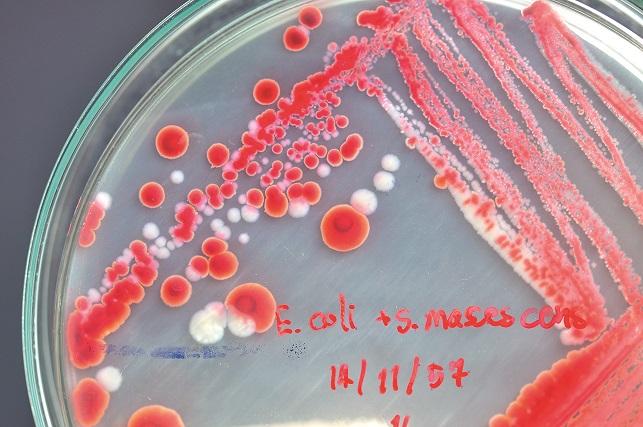 Mikroorganismy mohou vyvolávat nepříjemné svědění a červenání.