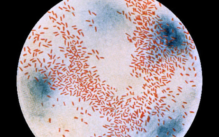 Původcem onemocnění je bakterie Haemophilus influenzae, která se u člověka vyskytuje většinou naprosto bezpříznakově.