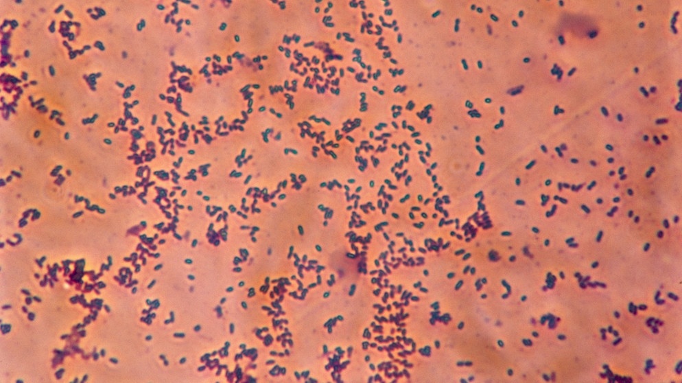 Haemophilus influenzae в носу. Гемофильная палочка микроскопия. Haemophilus influenzae микробиология. Haemophilus influenzae (гемофильная палочка). Гемофильная палочка под микроскопом.