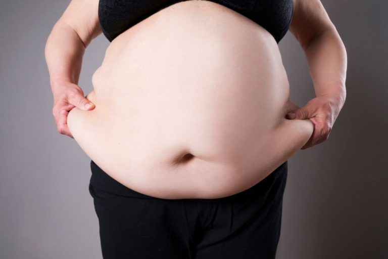 Obezita neovlivňuje jen plodnost žen, přestože jsou u nich změny lépe prokazatelné. Podle lékaře má vliv i na spermie.