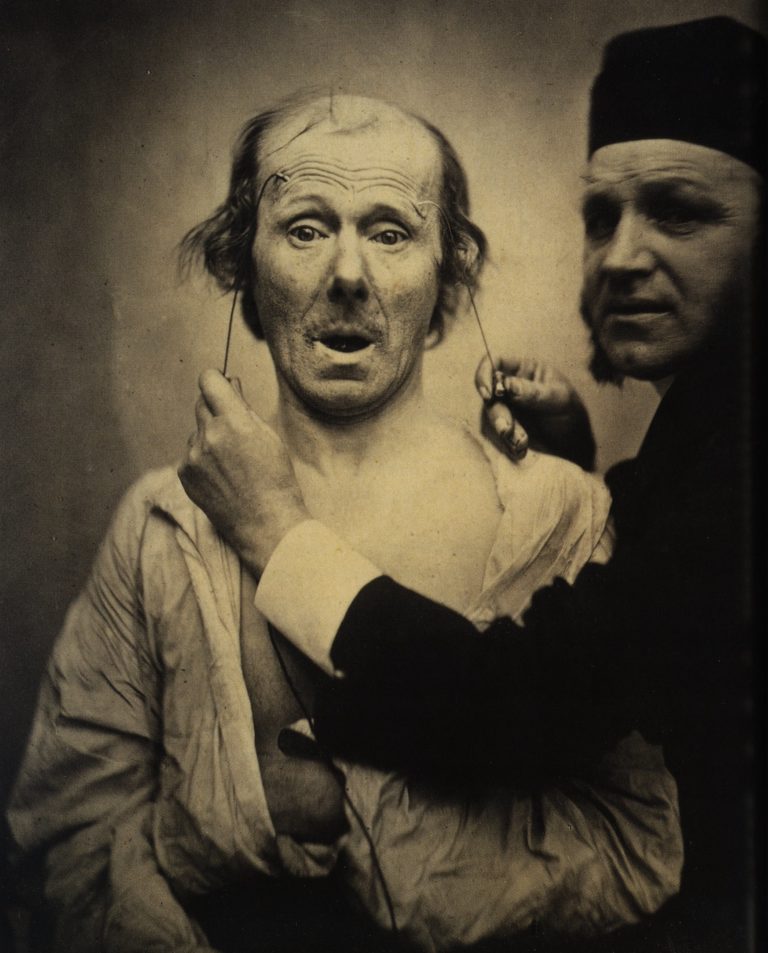 Prvním, kdo vytvořil medicínskou fotografii, se stal už v roce 1844 Léon Foucault (1819–1868) s mikroskopickými daguerrotypiemi krevních destiček.