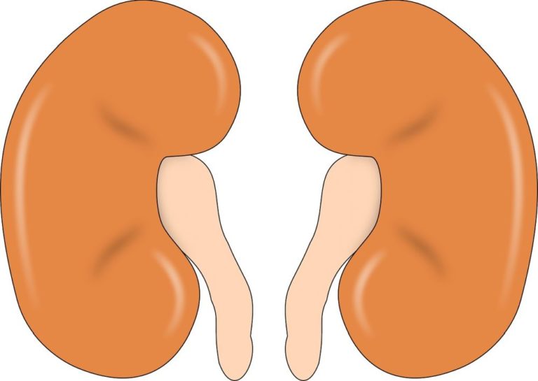 V případě selhání ledvin bývá u pacientů s PCHLAD nejvhodnějším řešením transplantace od žijícího dárce, nejlépe od geneticky příbuzného. Foto: balik / pixabay.com