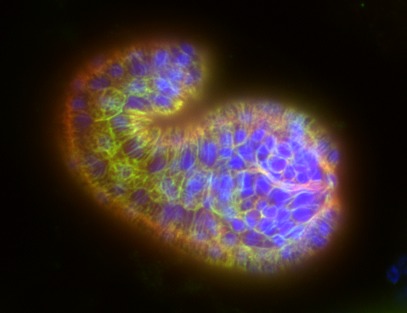 Výzkumníci také doufají ve vývoj buněčných struktur, tkání, a dokonce i celých orgánů, jež by se daly využít pro transplantace. Foto: Monica Gotta / Creative Commons / PD-self