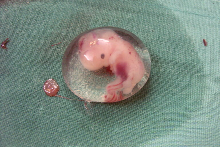Pokud se sejdou v děloze dvě embrya, pak mohou v raných fázích vývoje splynout - vznikne jedinec, jehož jednotlivé buňky si nejsou příbuzné víc než na 50 %. Foto: Jacopo Werther / Creative Commons / CC-BY-SA-3.0