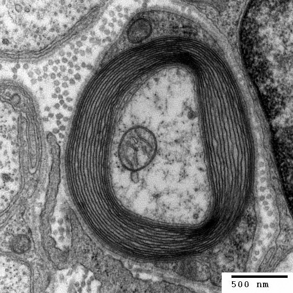 Myelinizovaný výběžek nervoév buňky, neboli axon. Obraz z elektronového mikroskopu.