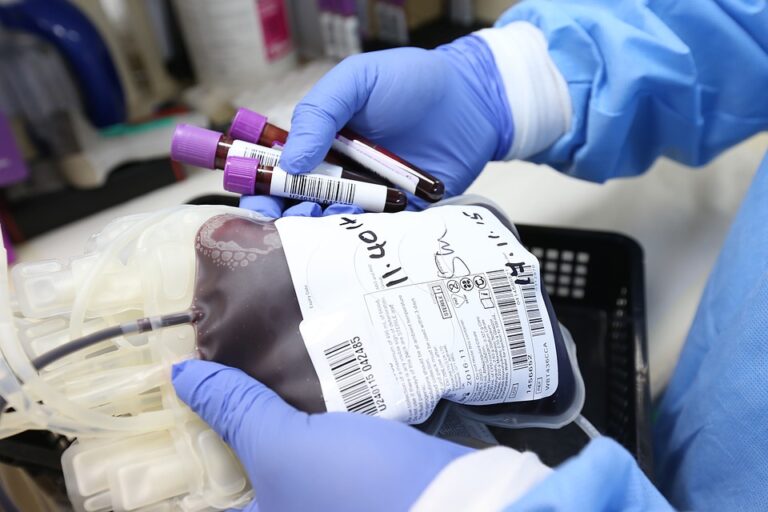 Darovaná plazma z center Cara Plasma se využívá k výrobě životně důležitých léků, které pomáhají pacientům s poruchami srážlivosti krve, sníženou imunitou nebo onkologickými onemocněními. Foto: Pixabay