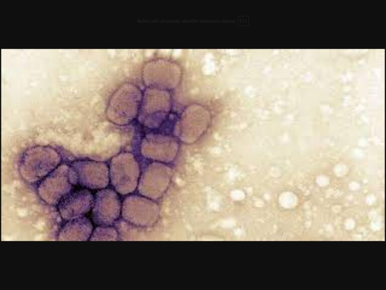 Virus neštovic pod mikroskopem