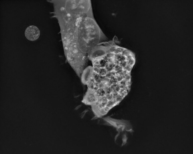Naegleria fowleri atakuje lidskou buňku. Foto: Ronald Malych