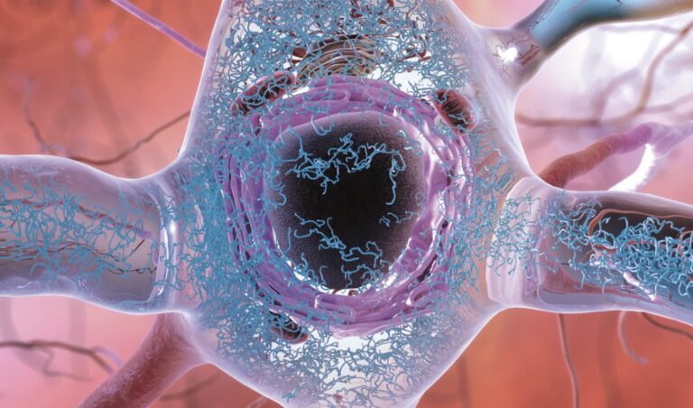 Po transformaci na prion získává protein mnohem větší odolnost vůči rozkladu enzymy, což komplikuje vývoj léků. Foto: National Institute On Aging