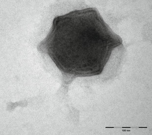 Budvirus TEM: Nově objevený Budvirus, snímek z transmisního elektronového mikroskopu. Foto: BC AV ČR