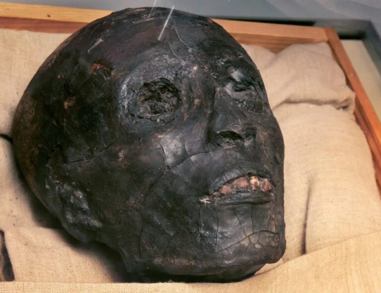 Tutanchamon měl zuby zdravé a bez kazů. Vadou na kráse byl však výrazný předkus.