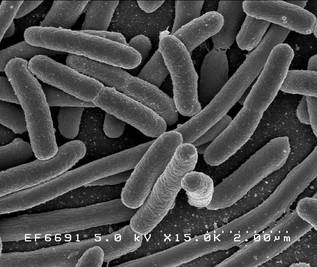 Obr. 3 – Escherichia coli
